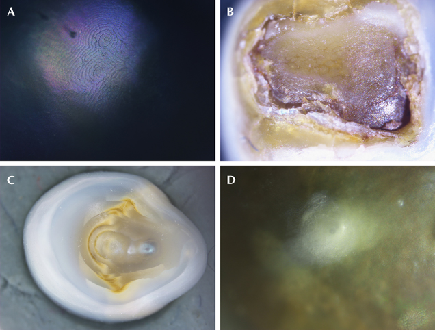 Figure 3. A: A spiral nacreous terrace structure on pearl A-2. B: The base of pearl C-4 with uneven organic-rich layers. C: Concave base on pearl D-4 with cores and nuclei seen through translucent nacre. D: Subsurface white spots on pearl B-1. Photomicrographs by Nishka Vaz; fields of view 0.5 mm (A), 1.3 mm (B), 3.2 mm (C), and 0.85 mm (D).