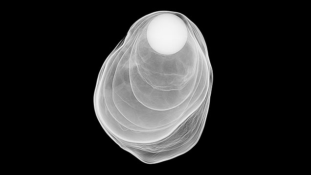 Figure 2. RTX image showing concentric nacre layers separated by translucent organic material.