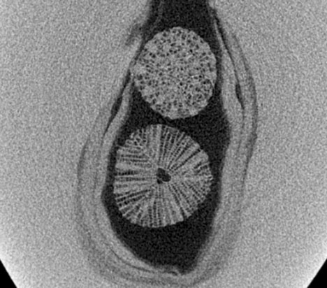 Figure 3. A distinctive porous and radial structure extends outward from the chamber central core of the two white microscopic marine organisms within the elongated dark gray void of the 2.33 ct pearl.