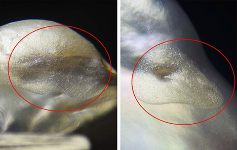 Two fillings displayed a coarser appearance and lower luster than the rest of the pearl.