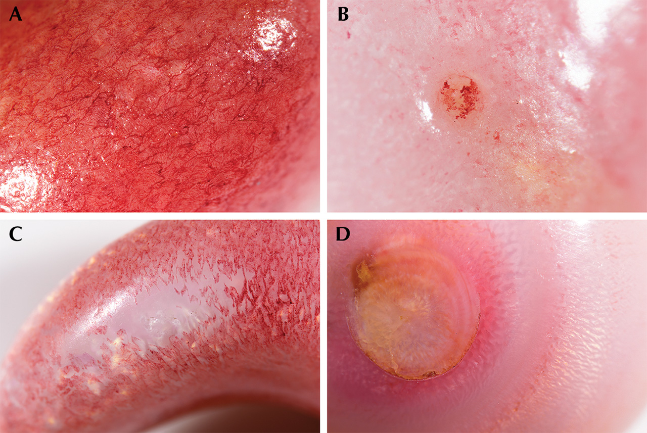 Visible dye concentrations in the four non-nacreous pearls.