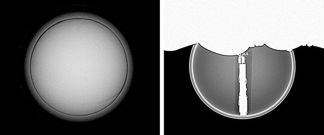 RTX microradiographs of two bead cultured pearls RTX microradiographs of two bead cultured pearls