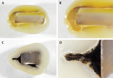 Cross sections of two “box bead” cultured pearl samples. Cross sections of two “box bead” cultured pearl samples.
