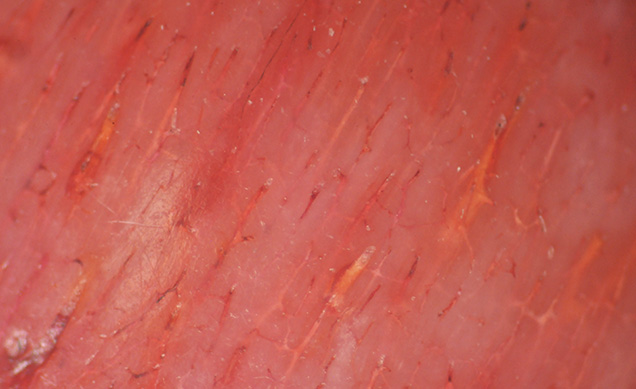 Dyed bone displays subparallel veins Dyed bone displays subparallel veins