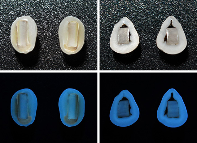 Cross sections of two “box bead” cultured pearl samples with their reactions under long-wave UV. Cross sections of two “box bead” cultured pearl samples with their reactions under long-wave UV.