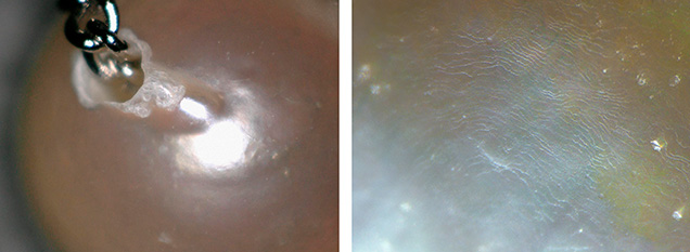 Figure 2. Left: The bumpy surface around the drill hole. Right: Magnification of the pearl surface showing the nacre’s terrace structure. Photomicrographs by Mari Sasaki.