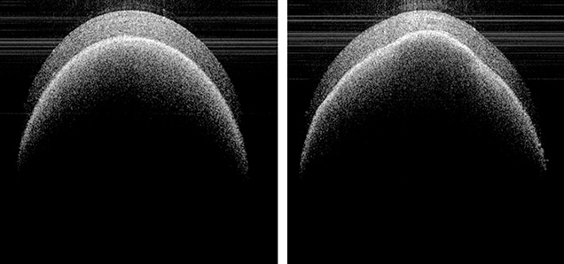 Figure 3. OCT images of the pearl. Left: The middle of the pearl, where the nacre thickness measured ~0.35 mm. Right: The bumpy area, where the nacre thickness measured ~0.23 mm. Images by Kazuko Saruwatari.