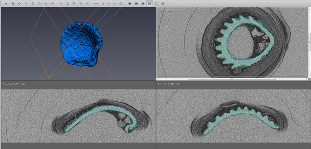 Extraction of the internal structures using 3-D software Extraction of the internal structures using 3-D software