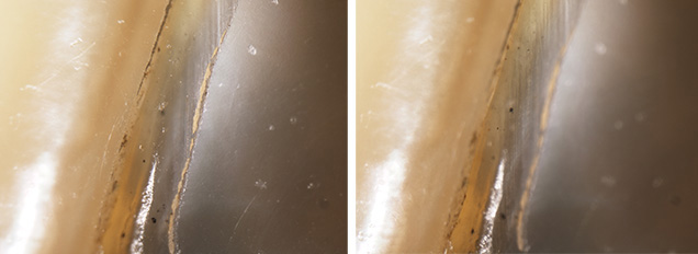 Pearl assembly deterioration Pearl assembly deterioration