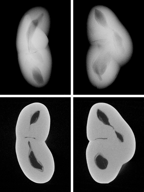 RTX and μ-CT images of non-bead-cultured pearl RTX and μ-CT images of non-bead-cultured pearl