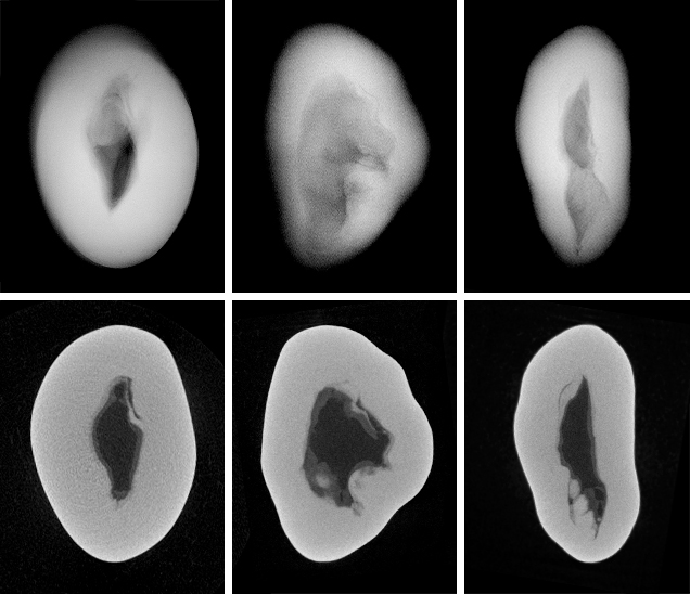 RTX and μ-CT images for a non-bead-cultured pearl RTX and μ-CT images for a non-bead-cultured pearl
