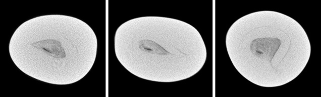 μ-CT slices of cultured pearl μ-CT slices of cultured pearl