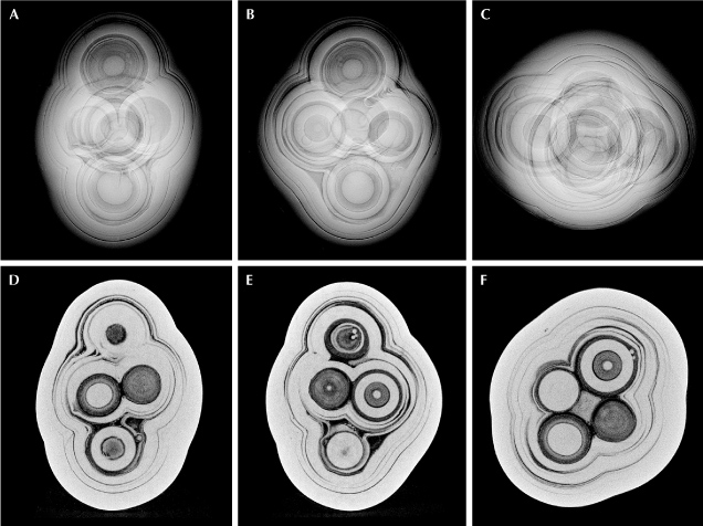 Figure 2. Top: RTX images revealing the pearl’s complex multicore internal structure. Bottom: μ-CT images displaying the six cores present inside the pearl. Figure 2. Top: RTX images revealing the pearl’s complex multicore internal structure. Bottom: μ-CT images displaying the six cores present inside the pearl.