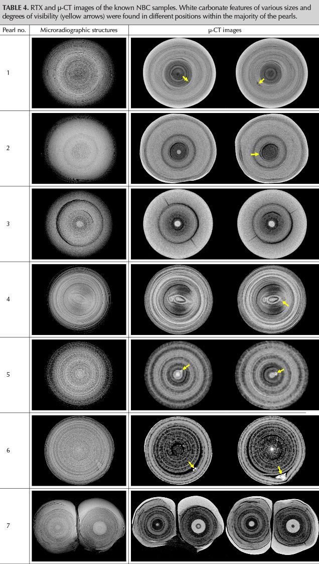 RTX and μ-CT images of the known NBC samples. White carbonate features of various sizes and degrees of visibility (yellow arrows) were found in different positions within the majority of the pearls.