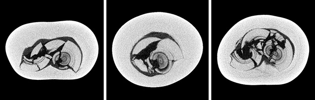 μ-CT slices in three directions of a natural P. maxima sample