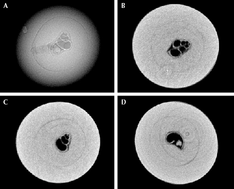 Figure 2. The gastropod shell, measuring approximately 0.50 × 0.30 mm, observed in pearl A. A: RTX image of the shell. B–D: μ-CT scans of the shell in the X, Y, and Z directions, respectively. (The weak white rings on the lower right image are artifacts and not pearl-related structures.) Figure 2. The gastropod shell, measuring approximately 0.50 × 0.30 mm, observed in pearl A. A: RTX image of the shell. B–D: μ-CT scans of the shell in the X, Y, and Z directions, respectively. (The weak white rings on the lower right image are artifacts and not pearl-related structures.)