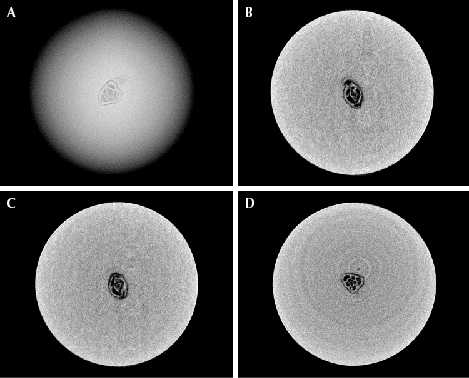 Figure 3. The foraminifera test, measuring approximately 0.45 × 0.35 mm, observed in pearl B. A: RTX image of the foraminifera test. B–D: μ-CT scans of the foraminifera test in the X, Y, and Z directions, respectively. (Again, the weak white rings on the lower right image are artifacts.) Figure 3. The foraminifera test, measuring approximately 0.45 × 0.35 mm, observed in pearl B. A: RTX image of the foraminifera test. B–D: μ-CT scans of the foraminifera test in the X, Y, and Z directions, respectively. (Again, the weak white rings on the lower right image are artifacts.)