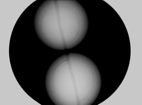 X-ray of Chinese bead-cultured pearl