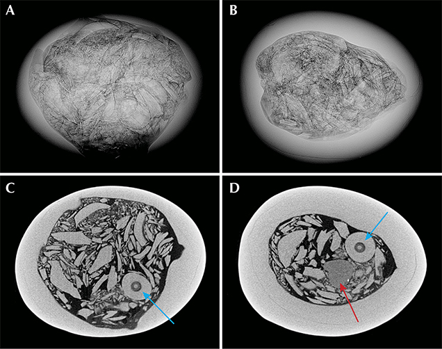 RTX and μ-CT images of the internal structure of the pearl. RTX and μ-CT images of the internal structure of the pearl.