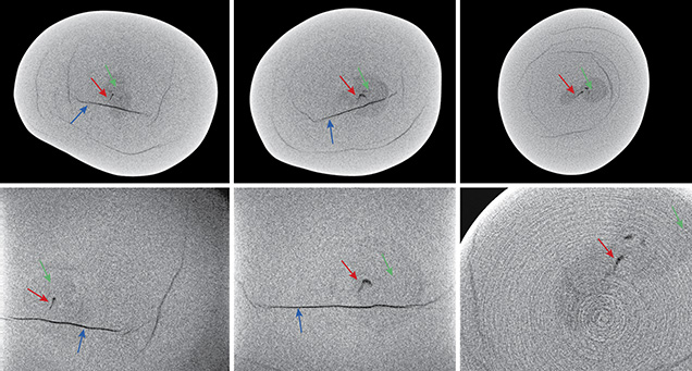 Three X-ray computed microtomography slices of a pearl Three X-ray computed microtomography slices of a pearl