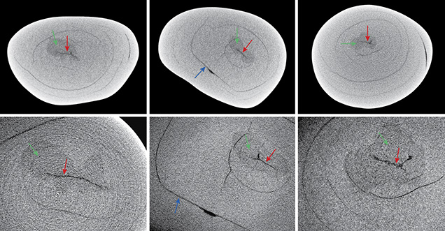 Three X-ray computed microtomography slices of a pearl Three X-ray computed microtomography slices of a pearl