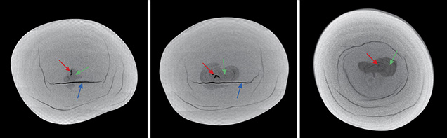 Three X-ray computed microtomography slices of a pearl Three X-ray computed microtomography slices of a pearl