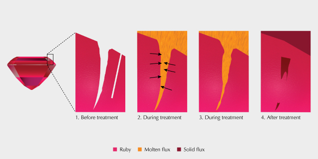 Figure 10. The process of flux healing of fractures during high-temperature heat treatment of ruby in the presence of a fluxing agent. Fractures naturally occurring in a ruby become filled with a molten flux during heating and partially recrystallize corundum. After treatment, some of the molten flux is trapped in these partially healed fractures and solidifies. Illustration by Peter Johnston. Figure 10. The process of flux healing of fractures during high-temperature heat treatment of ruby in the presence of a fluxing agent. Fractures naturally occurring in a ruby become filled with a molten flux during heating and partially recrystallize corundum. After treatment, some of the molten flux is trapped in these partially healed fractures and solidifies. Illustration by Peter Johnston.