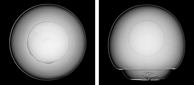 Figure 4. RTX imaging revealed a round bead nucleus in the center of each pearl, indicating the pearls were bead cultured. Images by Stephanie Shaw. Figure 4. RTX imaging revealed a round bead nucleus in the center of each pearl, indicating the pearls were bead cultured. Images by Stephanie Shaw.
