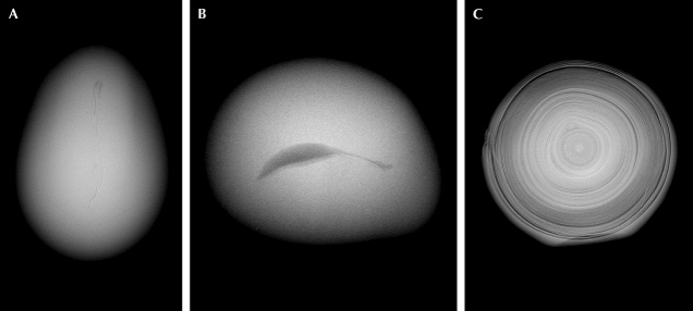 Figure 8. X-ray microradiographs of three saltwater non-bead cultured pearls obtained from Pinctada maxima pearl oysters (Homkrajae et al., 2021b). These pearls show central irregular linear structure (A), central irregular void structure (B), and evenly spaced alternating nacre and organic layers with a white core in the center (C). Figure 8. X-ray microradiographs of three saltwater non-bead cultured pearls obtained from Pinctada maxima pearl oysters (Homkrajae et al., 2021b). These pearls show central irregular linear structure (A), central irregular void structure (B), and evenly spaced alternating nacre and organic layers with a white core in the center (C).