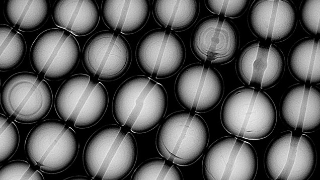 Figure 9. A section of a multi-strand necklace containing natural saltwater pearls from Pinctada species. Various natural growth structures can be found inside these pearls with X-ray microradiography. Figure 9. A section of a multi-strand necklace containing natural saltwater pearls from Pinctada species. Various natural growth structures can be found inside these pearls with X-ray microradiography.