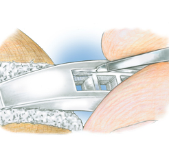 Perspective view of a platinum 4-prong solitaire with no diamonds set in the shank