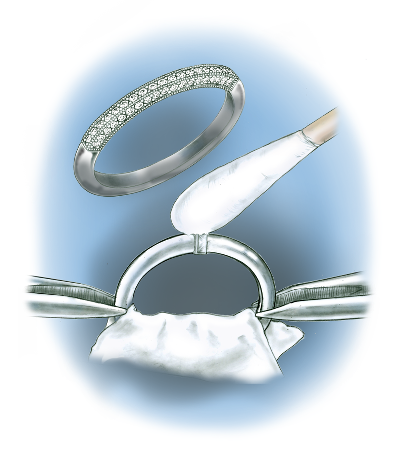 Learn how to evaluate the quality of a semi-finished assembled ring made from platinum cobalt components with these helpful illustrations and instructional video Learn how to evaluate the quality of a semi-finished assembled ring made from platinum cobalt components with these helpful illustrations and instructional video