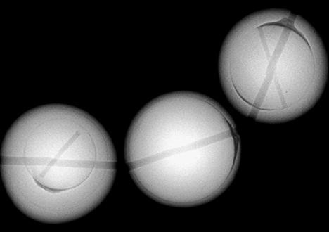 X-ray images of dyed freshwater cultured pearls.