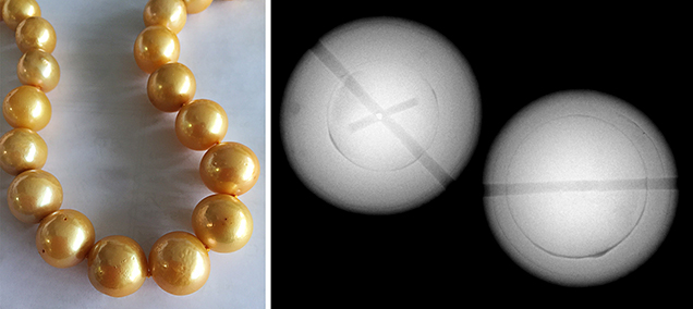 Left: Blemishes and dark color concentrations. Right: Bead within pearls.