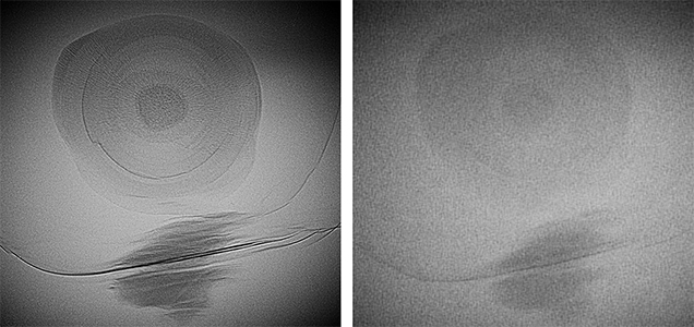 Microradiographs produced with an FPD (left) and an II (right) Microradiographs produced with an FPD (left) and an II (right)