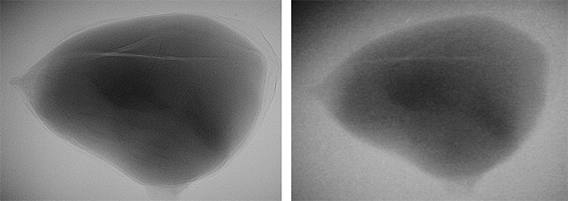 Figure 4. Microradiographs of the center of sample 19 (a non-bead-cultured saltwater pearl from Pinctada maxima), produced with an FPD (left) and an II (right); fields of view approximately 7 mm.